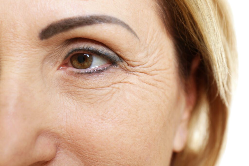 Woman with crow's feet wrinkles near eyes
