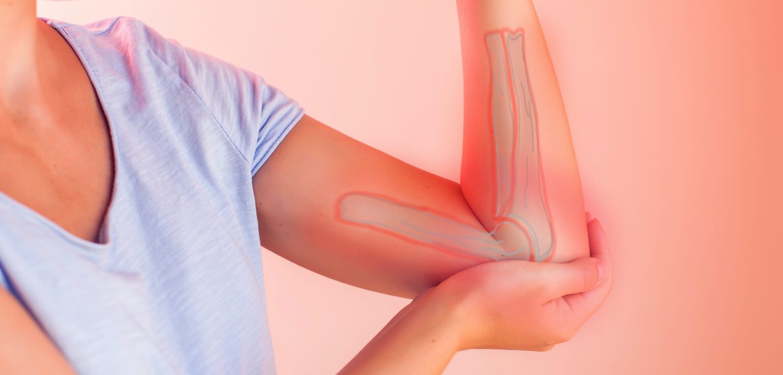 Painful joint inflammation of the elbow.