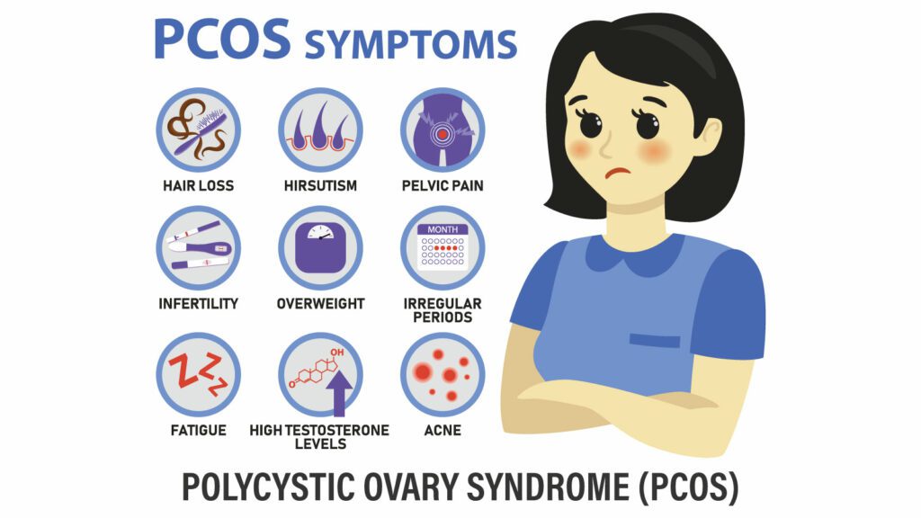 Symptoms of Polycystic Ovary Syndrome, or PCOS.